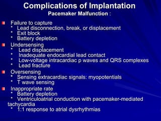 Myopotentials 0 pacemakers and icds an overview-samir rafla-shorta conference | PDF