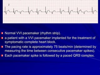 0 pacemakers and icds an overview-samir rafla-shorta conference | PDF