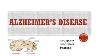 ALZHEIMER’S DISEASE
T.SOUJANYA
16DC1T0021
PHARM.D
 