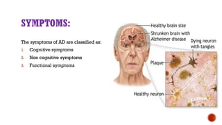Pathophysiology and management of alzheimer's disease | PDF
