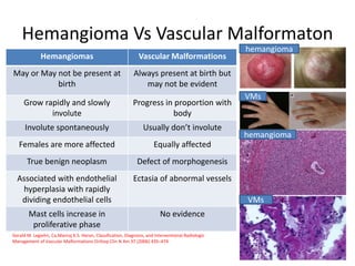 Hemangioma Vs Vascular Malformaton
Hemangiomas Vascular Malformations
Rare causes bony
/cartilagenous distortion or
hypert...
