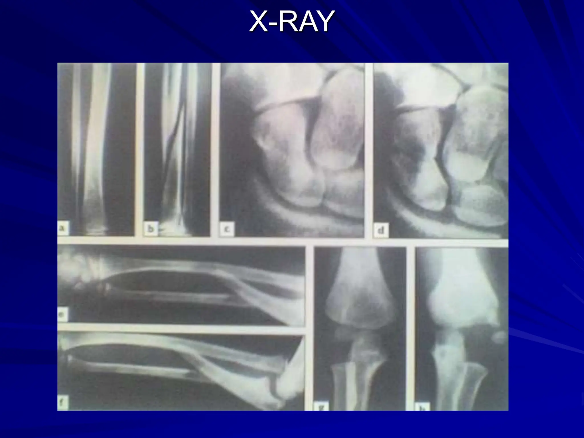 X-RAY
 