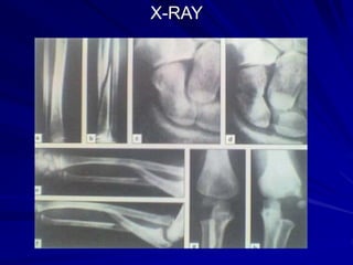 X-RAY
 