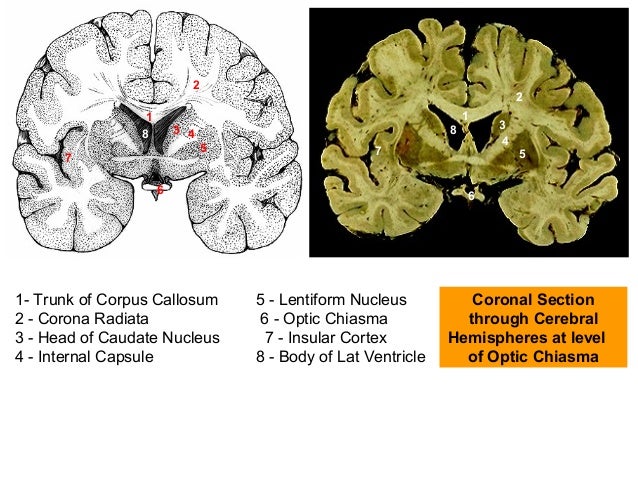 cerebrum sections for revision