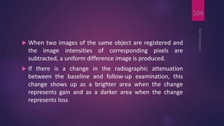  When two images of the same object are registered and
the image intensities of corresponding pixels are
subtracted, a uniform difference image is produced.
 If there is a change in the radiographic attenuation
between the baseline and follow-up examination, this
change shows up as a brighter area when the change
represents gain and as a darker area when the change
represents loss
DigitalRadiography
104
 