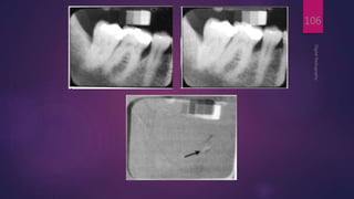 DigitalRadiography
106
 