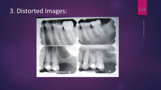 3. Distorted Images:
DigitalRadiography
116
 