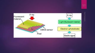 DigitalRadiography
57
 