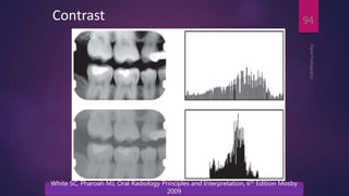 Contrast
DigitalRadiography
94
White SC, Pharoah MJ, Oral Radiology Principles and Interpretation, 6th Edition Mosby
2009
 