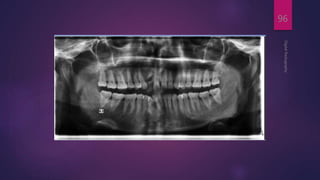 DigitalRadiography
96
 