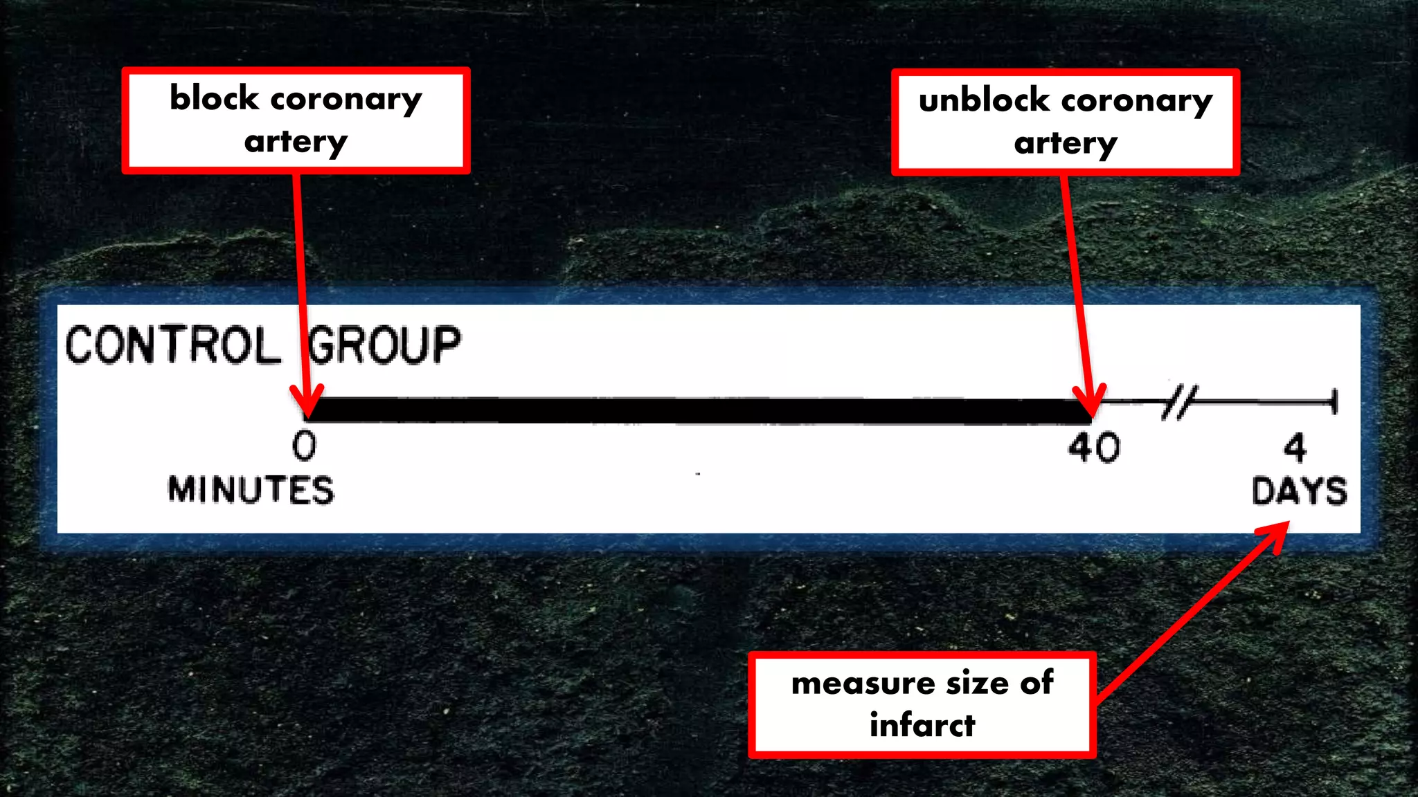 block coronary
artery
unblock coronary
artery
measure size of
infarct
 