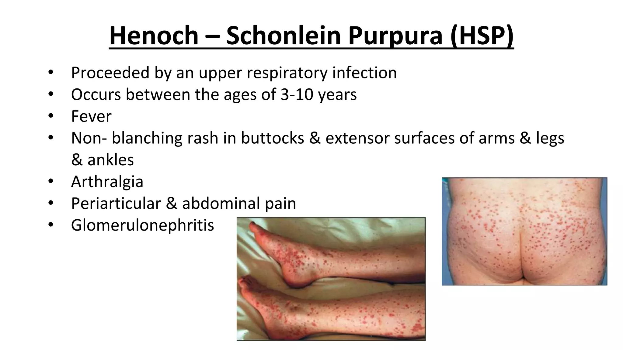 haematuria-pptx