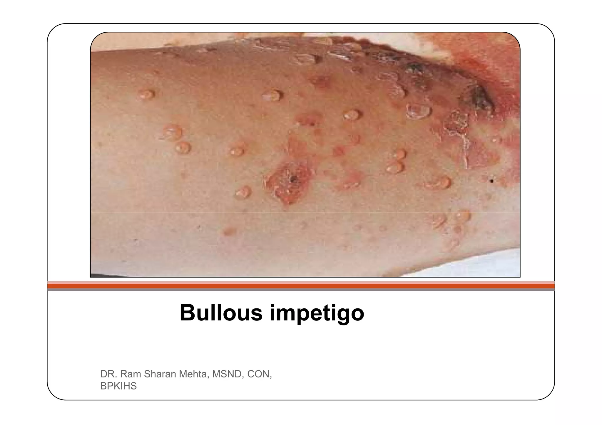 1.1.1. bacterial infection of skin [compatibility mode] | PDF