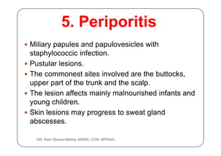 1.1.1. bacterial infection of skin [compatibility mode] | PDF