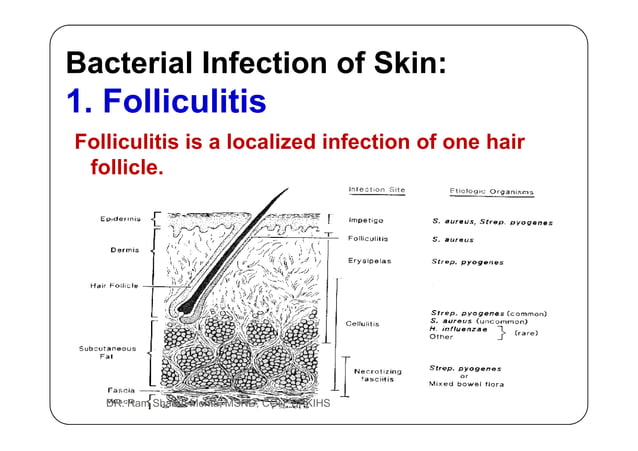 1.1.1. bacterial infection of skin [compatibility mode] | PDF | Skin ...