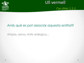 Ull vermell
                                      Cas clínic 1.1.1




Amb què es pot associar aquesta entitat?

Atòpia, asma, rinitis al.lèrgica...
 