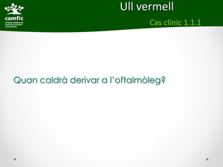 Ull vermell
                               Cas clínic 1.1.1




Quan caldrà derivar a l’oftalmòleg?
 