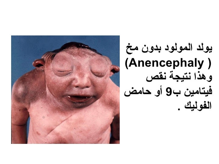 1حامض الفوليك