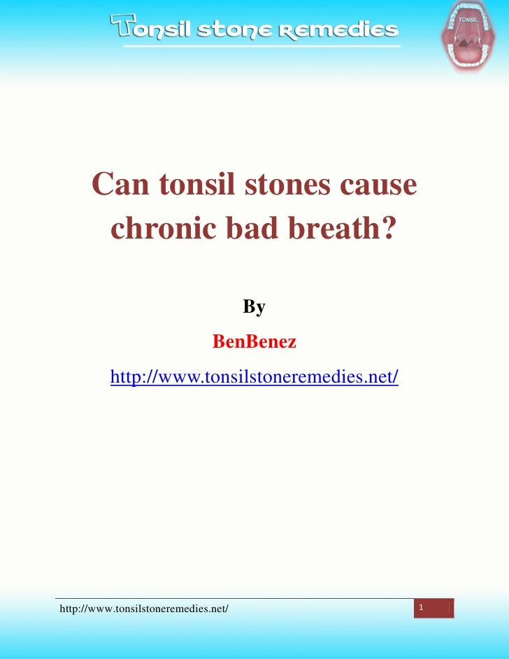 Can tonsil stones cause chronic bad breath?