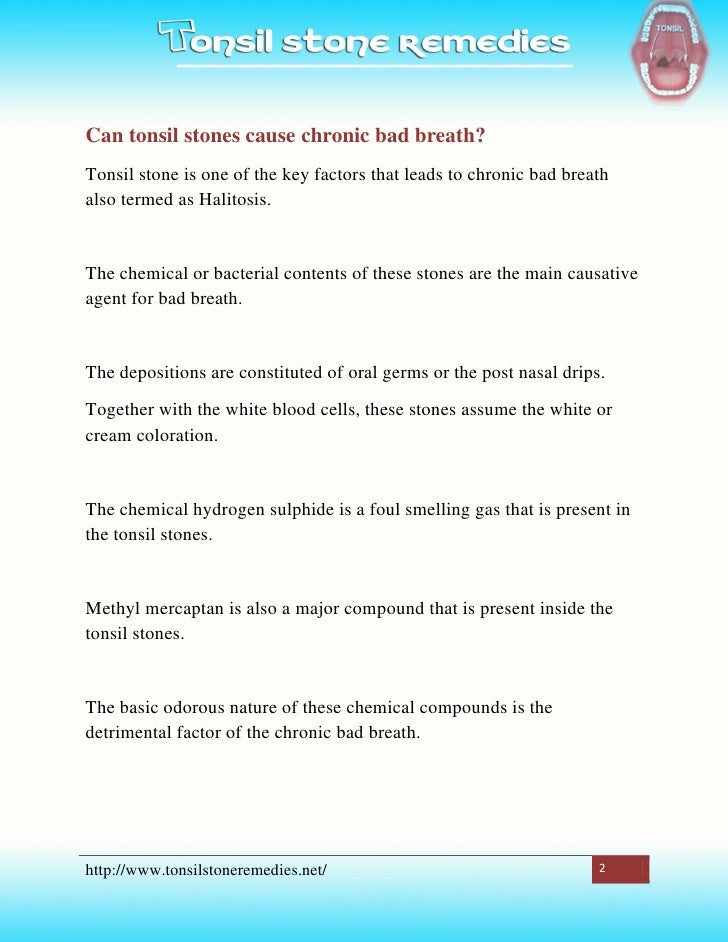 Can tonsil stones cause chronic bad breath?