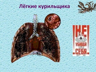 Лёгкие курильщика 