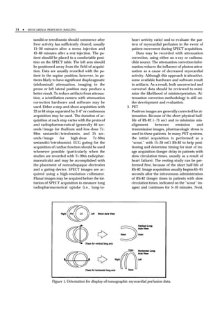14 •   MYOCARDIAL PERFUSION IMAGING


          tamibi or tetrofosmin should commence after                   heart activity ratio) and to evaluate the pat-
          liver activity has sufficiently cleared, usually              tern of myocardial perfusion in the event of
          15–30 minutes after a stress injection and                    patient movement during SPECT acquisition.
          45–60 minutes after a rest injection. The pa-                     Data may be recorded with attenuation
          tient should be placed in a comfortable posi-                 correction, using either an x-ray or radionu-
          tion on the SPECT table. The left arm should                  clide source. The attenuation correction infor-
          be positioned away from the field of acquisi-                 mation reduces the influence of photon atten-
          tion. Data are usually recorded with the pa-                  uation as a cause of decreased myocardial
          tient in the supine position; however, in pa-                 activity. Although this approach is attractive,
          tients likely to have significant diaphragmatic               some available hardware and software result
          (abdominal) attenuation, imaging in the                       in artifacts. As a result, both uncorrected and
          prone or left lateral position may produce a                  corrected data should be reviewed to mini-
          better result. To reduce artifacts from attenua-              mize the likelihood of misinterpretation. At-
          tion, a scintillation camera with attenuation                 tenuation correction methodology is still un-
          correction hardware and software may be                       der development and evaluation.
          used. Either a step-and-shoot acquisition with             3. PET
          32 or 64 stops separated by 3–6° or continuous                Positron images are generally corrected for at-
          acquisition may be used. The duration of ac-                  tenuation. Because of the short physical half-
          quisition at each stop varies with the protocol               life of Rb-82 (~75 sec) and to minimize mis-
          and radiopharmaceutical (generally 40 sec-                    alignment       between        emission     and
          onds/image for thallium and low-dose Tc-                      transmission images, pharmacologic stress is
          99m sestamibi/tetrofosmin, and 25 sec-                        used in these patients. In many PET systems,
          onds/image         for    high-dose      Tc-99m               the initial acquisition is performed as a
          sestamibi/tetrofosmin). ECG gating for the                    “scout,” with 15–20 mCi Rb-82 to help posi-
          acquisition of cardiac function should be used                tioning and determine timing for start of im-
          whenever possible (particularly when the                      age acquisition (longer delay in patients with
          studies are recorded with Tc-99m radiophar-                   slow circulation times, usually as a result of
          maceuticals) and may be accomplished with                     heart failure). The resting study can be per-
          the placement of nonradiopaque electrodes                     formed first, because of the short half-life of
          and a gating device. SPECT images are ac-                     Rb-82. Image acquisition usually begins 65–95
          quired using a high-resolution collimator.                    seconds after the intravenous administration
          Planar images may be acquired before the ini-                 of Rb-82 (longer times in patients with slow
          tiation of SPECT acquisition to measure lung                  circulation times, indicated on the “scout” im-
          radiopharmaceutical uptake (i.e., lung-to-                    ages) and continues for 5–10 minutes. Next,




                      Figure 1. Orientation for display of tomographic myocardial perfusion data.
 