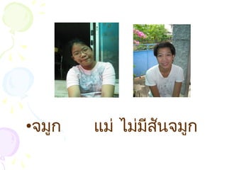 •จมูก แม่ ไม่มีสันจมูก
 