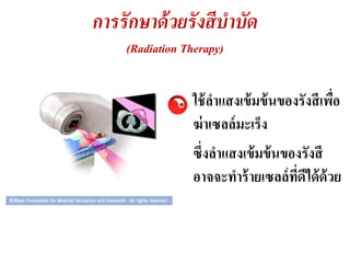 การรั กษาด้ วยรั งสีบาบัด
     (Radiation Therapy)


                  ใช้ ลาแสงเข้ มข้ นของรังสี เพือ
                                                ่
                  ฆ่ าเซลล์ มะ๶ร็ง
                  ซึ่งลาแสงเข้ มข้ นของรังสี
                  อาจจะทาร้ ายเซลล์ ทดได้ ด้วย
                                      ี่ ี
 