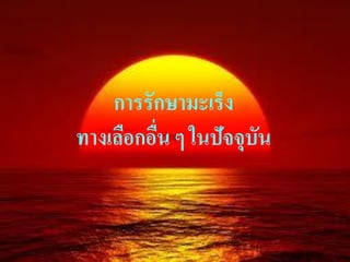 การรักษามะ๶ร็ง
ทางเลือกอืน ๆ ในปัจจุบัน
          ่
 