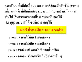 5.ฮอร์ โมน ทั้งทีปนเปื้ อนมาทางการบริโภคเนือสั ตว์ โดยเฉพาะ
                  ่                               ้
เนือแดง หรือทีมในพืชผักบางประเภท ทีบางครั้งบริโภคมาก
   ้            ่ ี                             ่
เกินไป เกินความสามารถทีร่างกายจะขับออกได้
                            ่
 6.อนุมูลอิสระ ทาให้ เซลล์ กลายพัดีน่ธุผู้ป่ด้วย
                                   ตอ ์ ไ
                                มะ๶ร็ง
             มะ๶ร็งในระดับ ต่ าง ๆ 4 ระดับ
   STAGE 1 ขนาดไม่ เกิน 2 เซนติเมตร
   STAGE 2 ขนาดไม่ เกิน 5 เซนติเมตร
  STAGE 3 เซลล์ มะ๶ร็งลามไปทีต่อมนาเหลือง
                               ่       ้
  STAGE 4 เซลล์ มะเร็ งลามข้ ามไปสู่ อวัยวะอืน ๆ
                                             ่
 