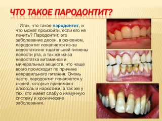 ЧТО ТАКОЕ ПАРОДОНТИТ?
   Итак, что такое пародонтит, и
 что может произойти, если его не
 лечить? Пародонтит, это
 заболевание десен, в основном,
 пародонтит появляется из-за
 недостаточно тщательной гигиены
 полости рта, а так же из-за
 недостатка витаминов и
 минеральных веществ, что чаще
 всего происходит по причине
 неправильного питания. Очень
 часто, пародонтит появляется у
 людей, которые принимают
 алкоголь и наркотики, а так же у
 тех, кто имеет слабую иммунную
 систему и хронические
 заболевания.
 