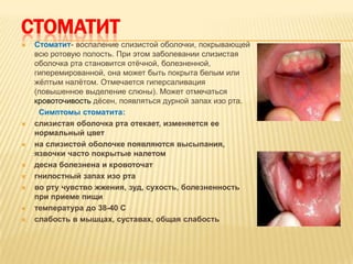СТОМАТИТ
   Стоматит- воспаление слизистой оболочки, покрывающей
    всю ротовую полость. При этом заболевании слизистая
    оболочка рта становится отѐчной, болезненной,
    гиперемированной, она может быть покрыта белым или
    жѐлтым налѐтом. Отмечается гиперсаливация
    (повышенное выделение слюны). Может отмечаться
    кровоточивость дѐсен, появляться дурной запах изо рта.
     Симптомы стоматита:
   слизистая оболочка рта отекает, изменяется ее
    нормальный цвет
   на слизистой оболочке появляются высыпания,
    язвочки часто покрытые налетом
   десна болезнена и кровоточат
   гнилостный запах изо рта
   во рту чувство жжения, зуд, сухость, болезненность
    при приеме пищи
   температура до 38-40 С
   слабость в мышцах, суставах, общая слабость
 