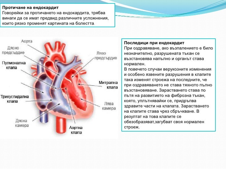 Радка Хаджийска - Ендокардит