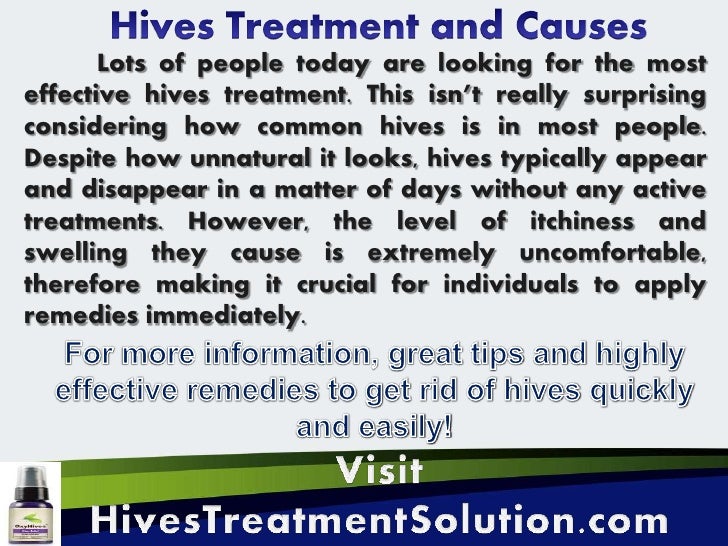 Hives treatment mayo clinic
