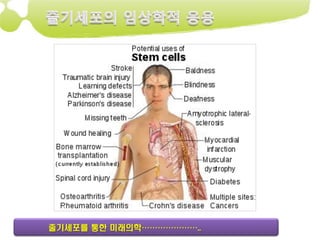 줄기세포를 통한 미래의학…………………..
 