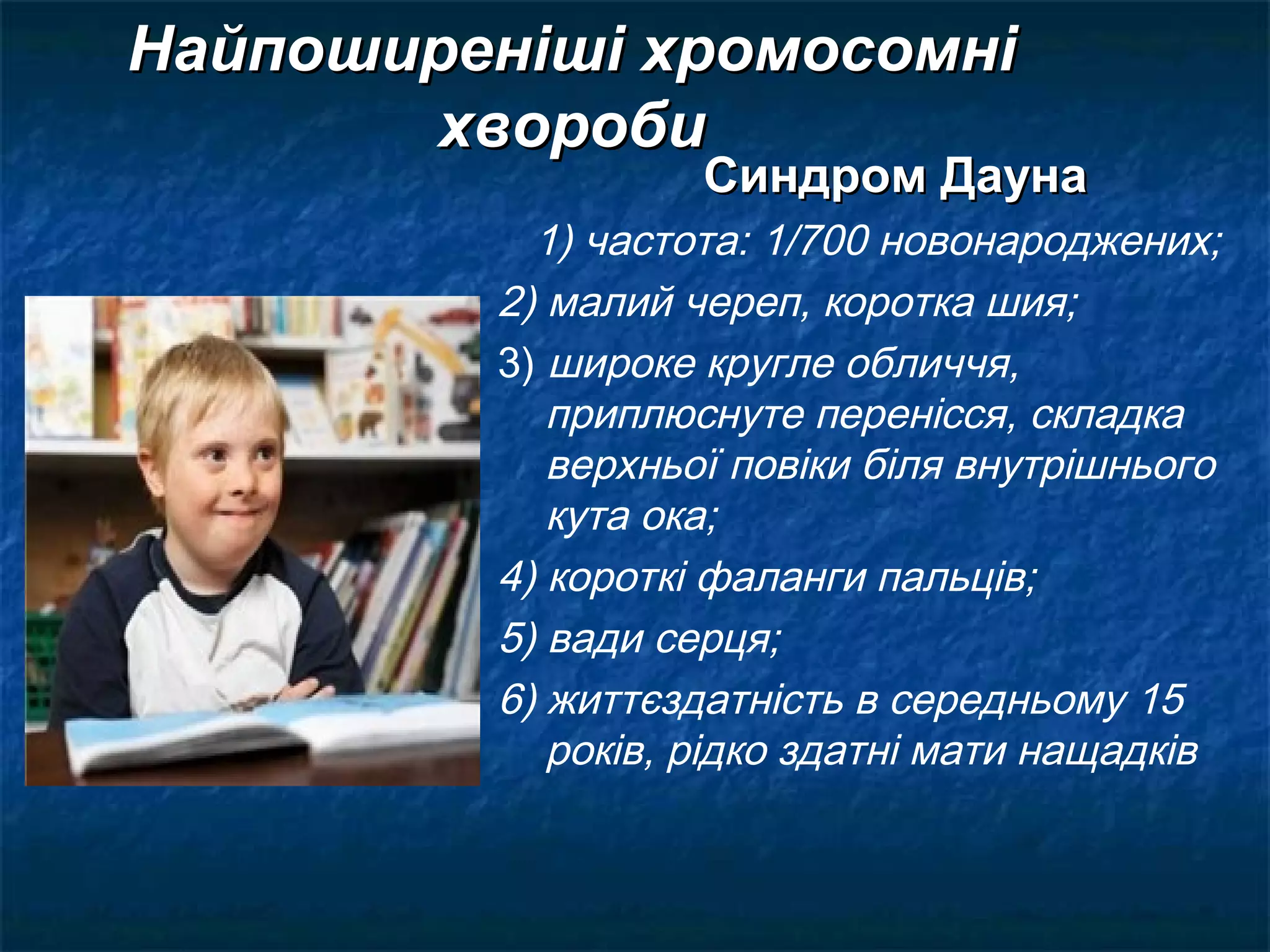 Найпоширеніші хромосомні
       хвороби
                   Синдром Дауна
           1) частота: 1/700 новонароджених;
         2) малий череп, коротка шия;
         3) широке кругле обличчя,
            приплюснуте перенісся, складка
            верхньої повіки біля внутрішнього
            кута ока;
         4) короткі фаланги пальців;
         5) вади серця;
         6) життєздатність в середньому 15
            років, рідко здатні мати нащадків
 