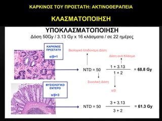 ΚΑΡΚΙΝΟΣ ΤΟΥ ΠΡΟΣΤΑΤΗ :  ΑΚΤΙΝΟΘΕΡΑΠΕΙΑ ΚΛΑΣΜΑΤΟΠΟΙΗΣΗ ΥΠΟΚΛΑΣΜΑΤΟΠΟΙΗΣΗ Δόση 50 Gy   /  3.13 Gy  x 16  κλάσματα /   σε 22 ημέρες ΚΑΡΚΙΝΟΣ ΠΡΟΣΤΑΤΗ α/β=1 ΦΥΣΙΟΛΟΓΙΚΟ ΕΝΤΕΡΟ α/β=3 N Τ D   =  50  1 + 2  1 + 3.13  =  68.8  Gy N Τ D   =  50  3  + 3.13  3  + 2  =  61.3   Gy Βιολογικά Ισοδύναμη Δόση Συνολική Δόση Δόση ανά Κλάσμα   α/β 