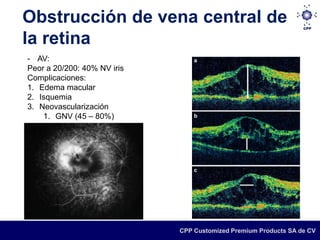 Obstrucción de vena central de
la retina
- AV:
Peor a 20/200: 40% NV iris
Complicaciones:
1. Edema macular
2. Isquemia
3. Neovascularización
    1. GNV (45 – 80%)




                             CPP Customized Premium Products SA de CV
 