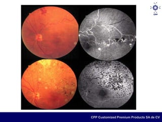 CPP Customized Premium Products SA de CV
 