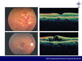 CPP Customized Premium Products SA de CV
 