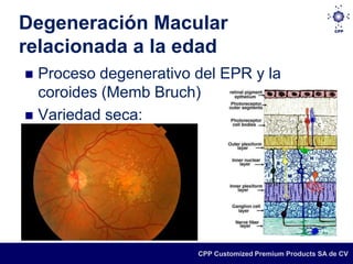 Degeneración Macular
relacionada a la edad
 Proceso degenerativo del EPR y la
  coroides (Memb Bruch)
 Variedad seca:




                       CPP Customized Premium Products SA de CV
 