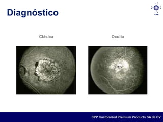 Diagnóstico

      Clásica              Oculta




                CPP Customized Premium Products SA de CV
 