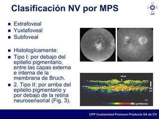 Clasificación NV por MPS
   Extrafoveal
   Yuxtafoveal
   Subfoveal

   Histologícamente:
   Tipo I: por debajo del
    epitelio pigmentario,
    entre las capas externa
    e interna de la
    membrana de Bruch.
   2. Tipo II: por arriba del
    epitelio pigmentario y
    por debajo de la retina
    neurosensorial (Fig. 3).

                                 CPP Customized Premium Products SA de CV
 