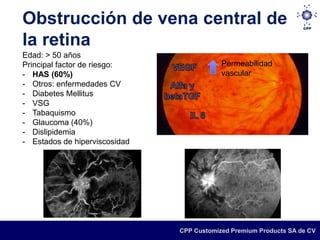 Obstrucción de vena central de
la retina
Edad: > 50 años
Principal factor de riesgo:                Permeabilidad
- HAS (60%)                                vascular
- Otros: enfermedades CV
- Diabetes Mellitus
- VSG
- Tabaquismo
- Glaucoma (40%)
- Dislipidemia
- Estados de hiperviscosidad




                               CPP Customized Premium Products SA de CV
 