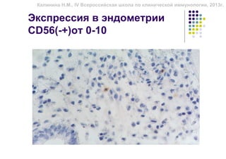 Калинина Н.М., IV Всероссийская школа по клинической иммунологии, 2013г.


Экспрессия в эндометрии
CD56(-+)от 0-10
 