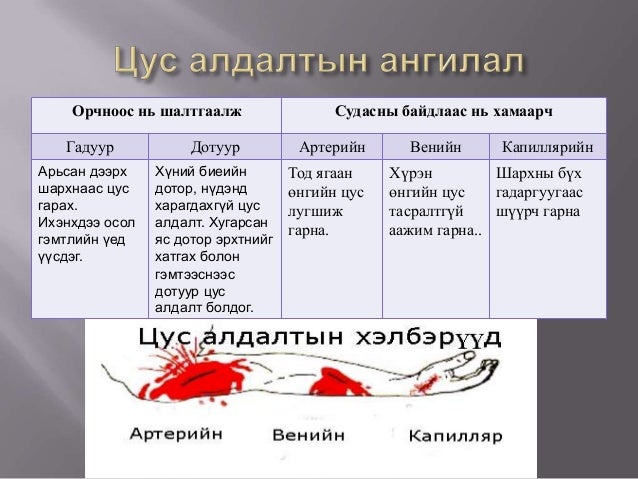 цус алдалтийн үед үзүүлэ х анхны тусламж 1
