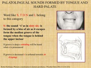 Palatal Letters 1.phonetics in cd | PPTX