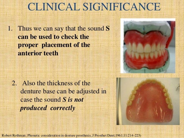 Dentures Definition Sentence  - Noun Plural Dentures Dentures Are Artificial Teeth Worn By People Who No Longer Have All Their Own Teeth.