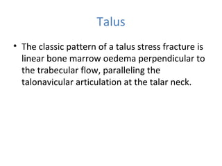 Talus
• The classic pattern of a talus stress fracture is
linear bone marrow oedema perpendicular to
the trabecular flow, paralleling the
talonavicular articulation at the talar neck.
 