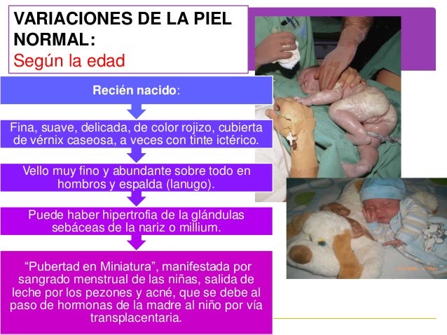 Los hombres con las pecas